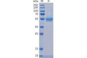 Human IL5RA Protein, His Tag on SDS-PAGE under reducing condition.