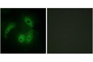 Immunofluorescence analysis of HeLa cells, using AKAP14 Antibody. (AKAP14 Antikörper  (AA 1-50))