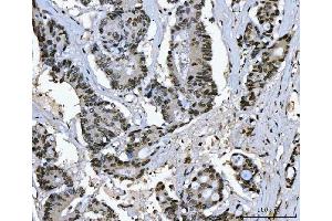 IHC analysis of Ki67/MKI67 using anti-Ki67/MKI67 antibody (ABIN7601873).