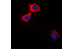 Immunofluorescent analysis of CaMK2 alpha/delta staining in HEK293A cells. (CaMK2 alpha/delta Antikörper  (Center))