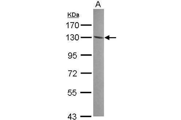 ENPP1 Antikörper