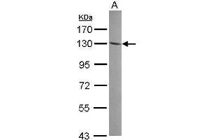 WB Image Sample (30 ug of whole cell lysate) A: A549 7. (ENPP1 Antikörper)