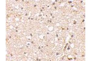 Immunohistochemical staining of human brain tissue using AP30381PU-N Grik1 antibody at 2. (GRIK1 Antikörper  (Center))
