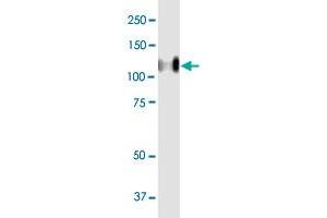 CEACAM1 MaxPab polyclonal antibody. (CEACAM1 Antikörper  (AA 1-464))