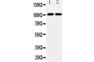 Anti-GRIA3 antibody, All Western blottingAll lanes: Anti-GRIA3  at 0. (Glutamate Receptor 3 Antikörper  (Middle Region))