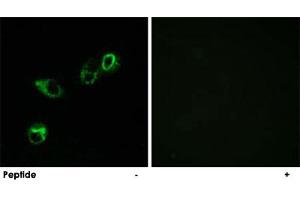 Immunofluorescence analysis of MCF-7 cells, using CCRL1 polyclonal antibody .