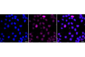 Immunocytochemical staining of HeLa cells with Olig2 antibody (ABIN7799699), 1:1,000).