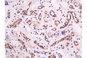 Formalin-fixed and paraffin embedded human kidney tissue labeled with Anti-CD18 (Thr758) Polyclonal Antibody, Unconjugated  at 1:200 followed by conjugation to the secondary antibody and DAB staining. (Integrin beta 2 Antikörper  (pThr758))