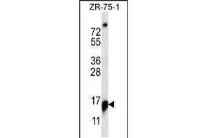 Western blot analysis in ZR-75-1 cell line lysates (35ug/lane). (RPP25 Antikörper  (C-Term))