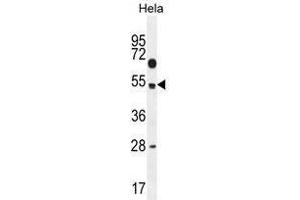 TSPYL6 Antibody (Center) western blot analysis in Hela cell line lysates (35 µg/lane). (TSPY-Like 6 Antikörper  (Middle Region))