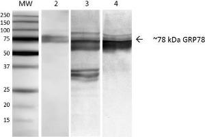 Western Blot analysis of Human, Mouse, Rat NIH3T3, Rat Brain, and HEK-293 cell lysates showing detection of ~78 kDa GRP78 protein using Mouse Anti-GRP78 Monoclonal Antibody, Clone 3C5-1A4 . (GRP78 Antikörper)
