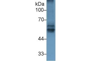 Detection of BACE2 in Rat Spleen lysate using Polyclonal Antibody to Beta Secretase 2 (BACE2) (BACE2 Antikörper  (AA 242-502))
