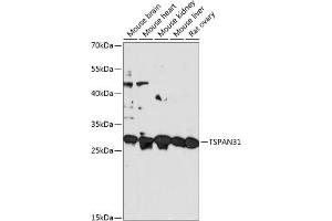 Western blot analysis of extracts of various cell lines, using TSP antibody (ABIN7270789) at 1:3000 dilution. (TSPAN31 Antikörper  (AA 95-175))
