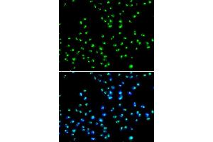 Immunofluorescence analysis of MCF-7 cells using NAT10 antibody. (NAT10 Antikörper)