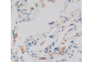 Immunohistochemistry (IHC) image for anti-Inversin (INVS) (AA 1-237) antibody (ABIN5013998)