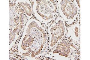 IHC analysis of CALR using anti-CALR antibody (ABIN7600329).