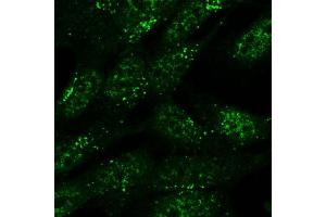 Immunofluorescence (IF) image for anti-Sorting Nexin 1 (SNX1) antibody (ABIN5877304) (Sorting Nexin 1 Antikörper)