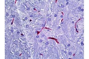 Anti-RECA-1 antibody IHC of rat brain, cerebellum vessels. (RECA-1 Antikörper)