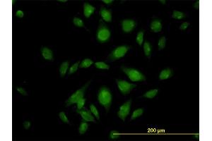 Immunofluorescence of monoclonal antibody to ATP2C1 on HeLa cell. (ATP2C1 Antikörper  (AA 119-269))