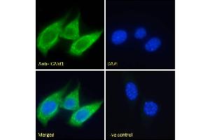 ABIN5539625 Immunofluorescence analysis of paraformaldehyde fixed NIH3T3 cells, permeabilized with 0. (ICAM1 Antikörper  (Internal Region))