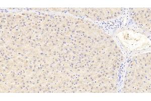 Detection of PCNT in Human Liver Tissue using Polyclonal Antibody to Pericentrin (PCNT) (PCNT Antikörper  (AA 2987-3246))