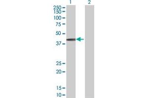 Lane 1: SPHK1 transfected lysate ( 43. (SPHK1 293T Cell Transient Overexpression Lysate(Denatured))