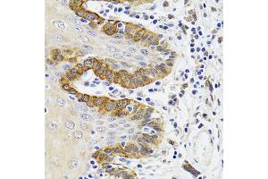 Immunohistochemistry of paraffin-embedded Human trachea using ESD antibody (ABIN1882355) at dilution of 1:100 (40x lens). (Esterase D Antikörper)