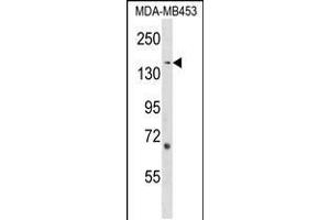 Western blot analysis in MDA-MB453 cell line lysates (35ug/lane). (ARHGEF11 Antikörper  (AA 605-632))