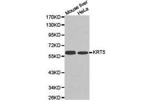 Western Blotting (WB) image for anti-Keratin 5 (KRT5) antibody (ABIN1873489)