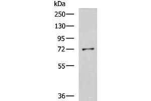 Western blot analysis of K562 cell lysate using GSTCD Polyclonal Antibody at dilution of 1:800 (GSTCD Antikörper)