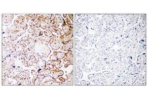 Immunohistochemistry analysis of paraffin-embedded human placenta tissue, using CCDC102B antibody. (CCDC102B Antikörper  (Internal Region))