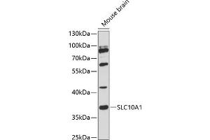 Western blot analysis of extracts of mouse brain, using SLC10 antibody (2721) at 1:3000 dilution.