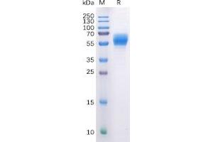 Human CB1 Protein, hFc Tag on SDS-PAGE under reducing condition.