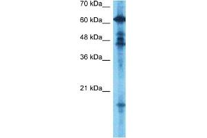 Host:  Rabbit  Target Name:  GCYB1  Sample Type:  Fetal Brain lysates  Antibody Dilution:  0. (GUCY1B3 Antikörper  (N-Term))