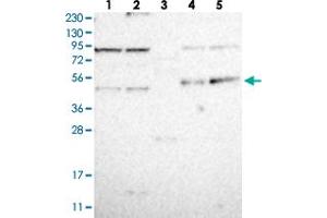 Western blot analysis of Lane 1: RT-4, Lane 2: U-251 MG, Lane 3: Human Plasma, Lane 4: Liver, Lane 5: Tonsil with CDCP2 polyclonal antibody . (CDCP2 Antikörper)