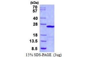 Ubiquitin-Conjugating Enzyme E2E 1 (UBE2E1) protein (His tag)