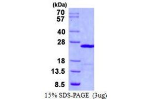 Image no. 1 for Ubiquitin-Conjugating Enzyme E2E 1 (UBE2E1) protein (His tag) (ABIN1098380) (UBE2E1 Protein (His tag))