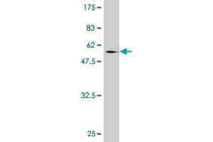 Western Blot detection against Immunogen (60. (NCOA5 Antikörper  (AA 1-315))