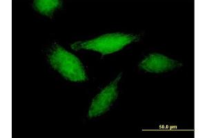 Immunofluorescence of purified MaxPab antibody to ANXA11 on HeLa cell. (Annexin A11 Antikörper  (AA 1-505))