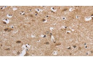 Immunohistochemistry of paraffin-embedded Human brain using SDCCAG3 Polyclonal Antibody at dilution of 1:30 (SDCCAG3 Antikörper)