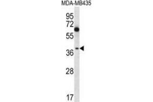 Western blot analysis in MDA-MB435 cell line lysates (35ug/lane) using NFKBIL1  Antibody  (C-term).