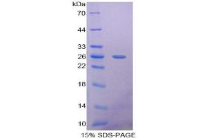 SDS-PAGE analysis of Rat Pentraxin 3 Protein. (PTX3 Protein)