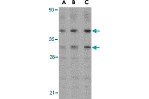Western blot analysis of MCL1 in Raji cell lysates with MCL1 polyclonal antibody  at (A) 0. (MCL-1 Antikörper  (Internal Region))