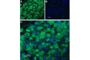 Expression of Serotonin receptor 3B in rat DRG - Immunohistochemical staining of rat dorsal root ganglion (DRG) frozen sections using Anti-5HT3B Receptor (HTR3B) (extracellular) Antibody (ABIN7043622 and ABIN7045285), followed by goat anti-rabbit-AlexaFluor-488 secondary antibody. (Serotonin Receptor 3B Antikörper  (Extracellular, N-Term))