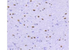 Immunohistochemistry (Paraffin-embedded Sections) (IHC (p)) image for anti-Histone Deacetylase 2 (HDAC2) antibody (ABIN5557480)