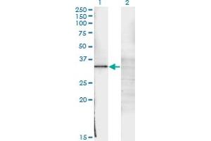Western Blot analysis of WT1 expression in transfected 293T cell line by WT1 monoclonal antibody (M02), clone 3B12. (WT1 Antikörper  (AA 349-439))