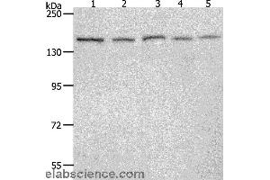 Western blot analysis of 293T, Hela, K562, NIH/3T3 and RAW264. (RAD50 Antikörper)