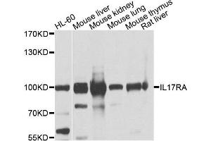 Western blot analysis of extracts of various cells, using IL17RA antibody. (IL17RA Antikörper)