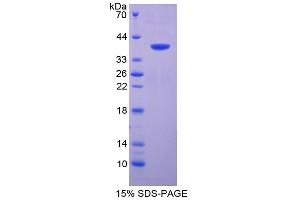 Image no. 1 for Surfactant Associated Protein A2 (SFTPA2) (AA 21-114) protein (His tag,GST tag) (ABIN6238550) (SFTPA2 Protein (AA 21-114) (His tag,GST tag))