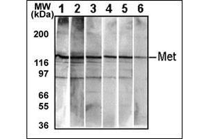 Detection of endogenous Met in HepG2 cell line. (c-MET Antikörper  (Catalytic Domain))